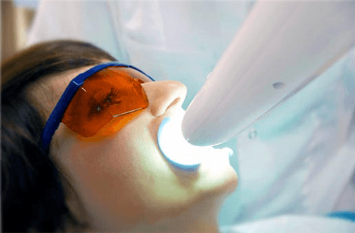Understanding the Causes of Teeth Sensitivity Brighton