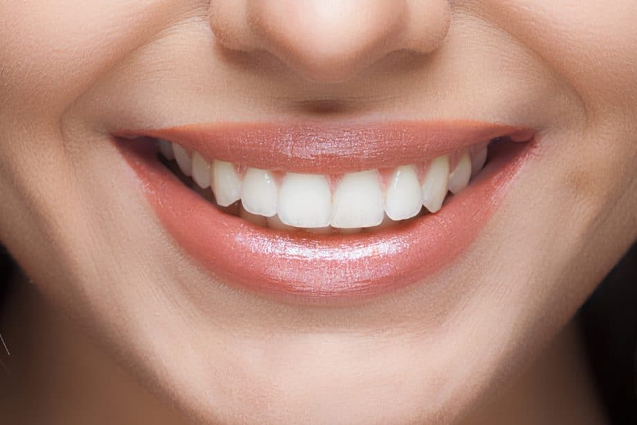 The Role of a Balanced Diet in Long-Term Whitening Results Brighton