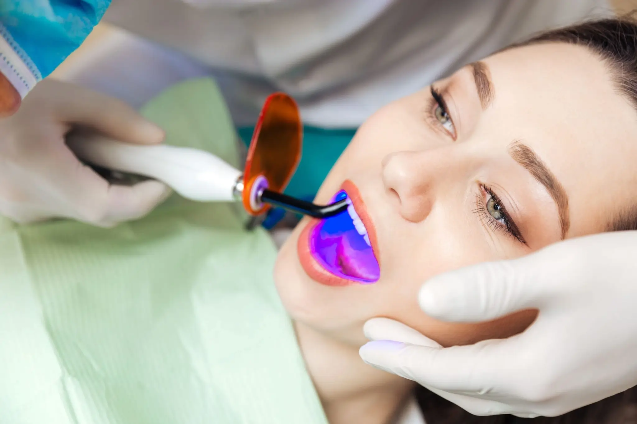 How Long Can You Expect Laser Teeth Whitening Results to Last Brighton?