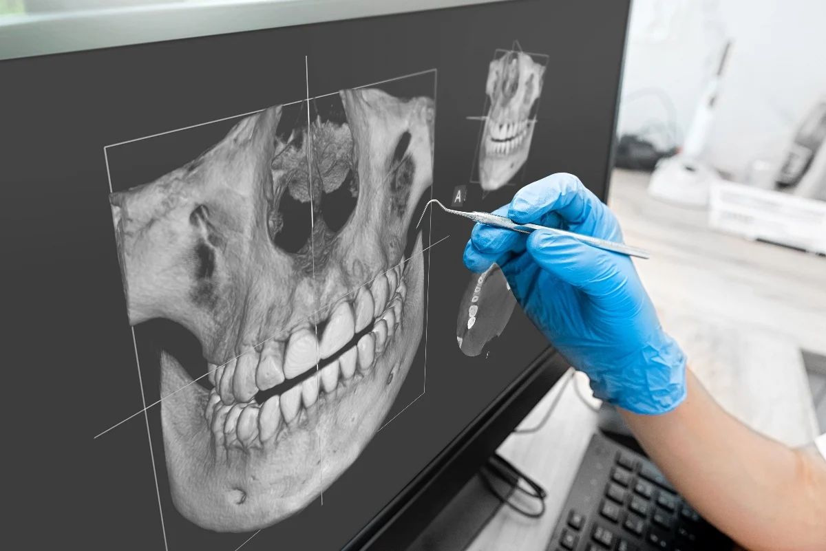 How Is AI Transforming Dental Treatment Planning Brighton?