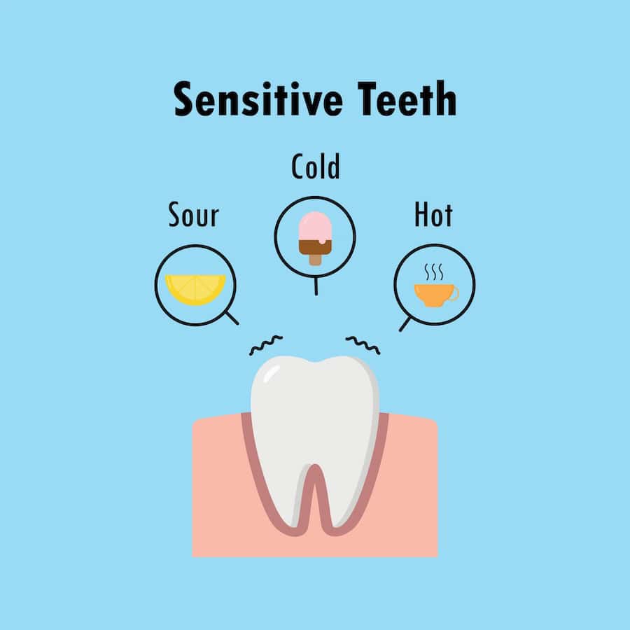 How Can You Tell If Your Teeth Are Becoming Sensitive Brighton?
