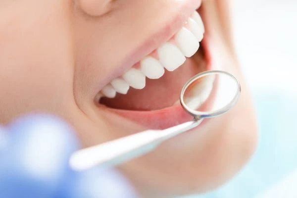 How Much Fluoride Do You Really Need Brighton?