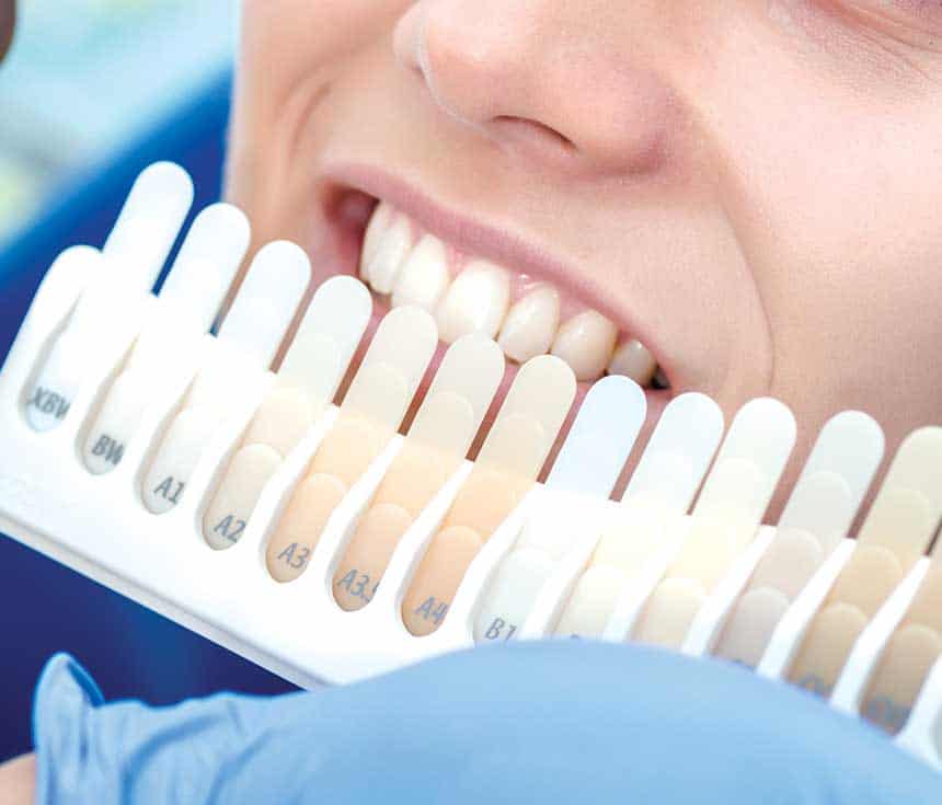 Is Laser Teeth Whitening Worth It for a Brighter, Confident Smile Brighton?