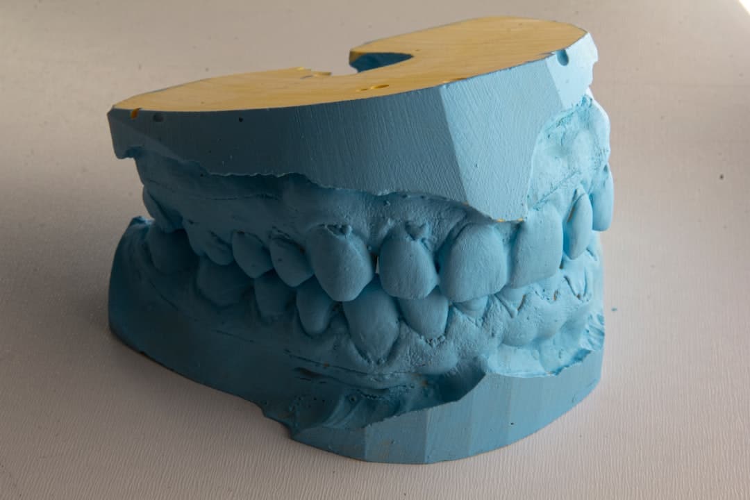 How Do Dental Implants Improve Jawbone Health and Oral Function Brighton?