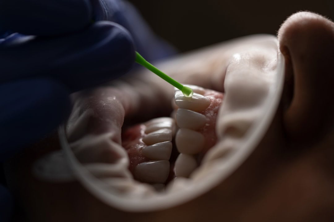 How Saliva Protects Your Teeth and Gums Brighton