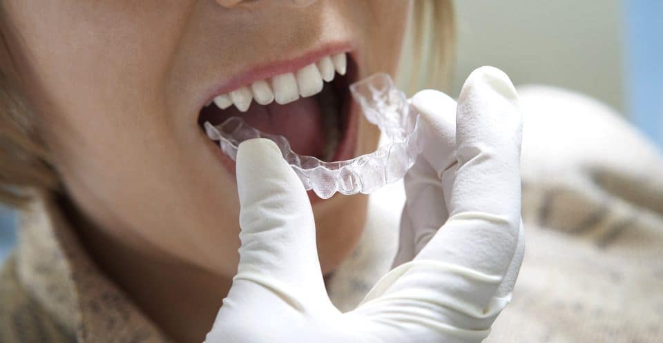 Can Bruxism Affect Your Sleep Quality Brighton