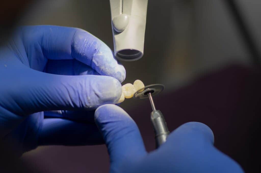 Customised Dental Solutions: Crowns, Aligners, and Implants Brighton