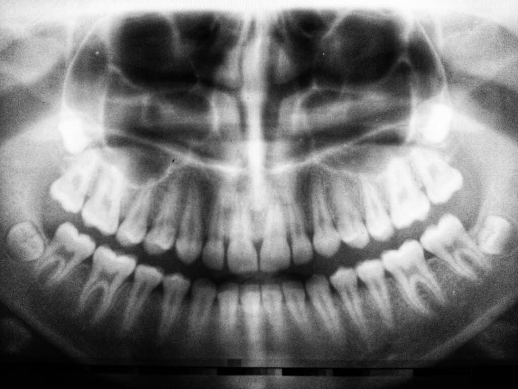 The Future of 3D Printing in Oral Healthcare Brighton